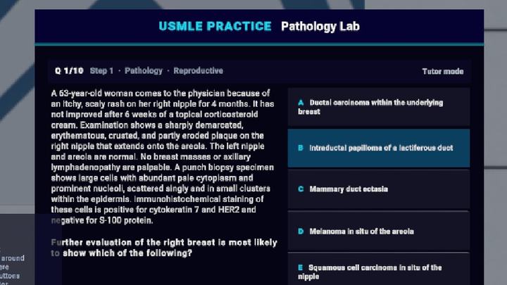 USMLE-style practice question with answer choices
